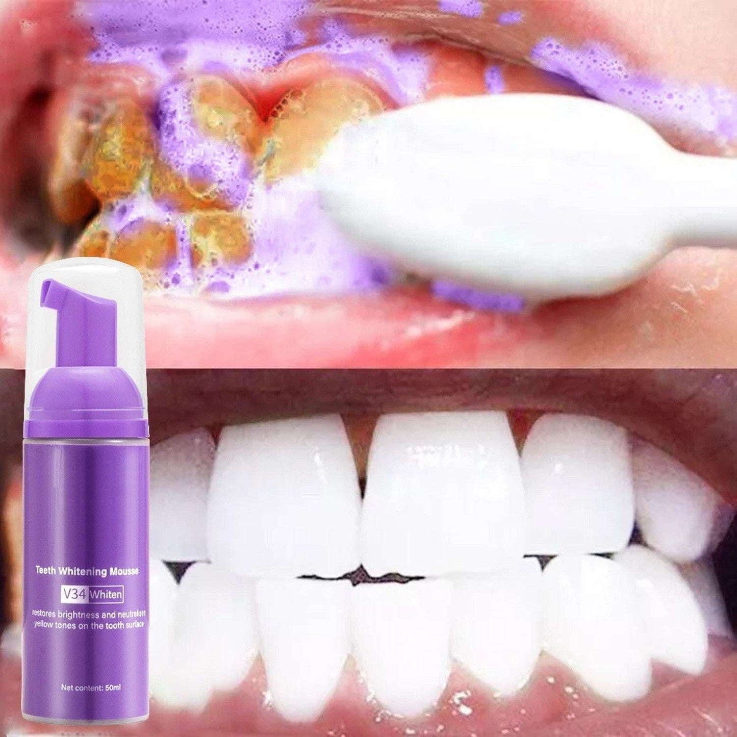 Oral Care Solution, Smoke Stain Removal, Teeth Mousse Cleaner - available at Sparq Mart